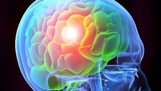 Stroke Awareness